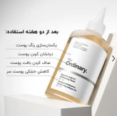 تونر گلیکولیک اسید 7% اوردینری (The Ordinary)