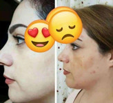 کرم طلای اصلی