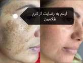 کرم طلای اصلی